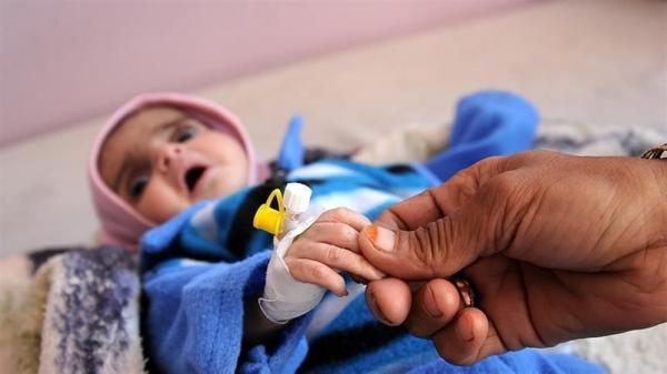 الصحة العالمية: 15 ألف طفل  يمني يعانون سوء تغذية حاد